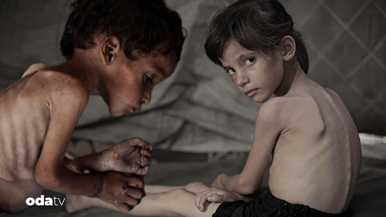 new york times daha fazla dayanamadi gazzede cocuklar acliktan eriyor hayatta kalanlarin gelecegi tehlikede gflZbqyD