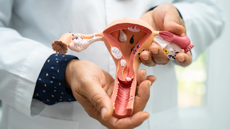 uzmani anlatti her on kadindan birinde polikistik over sendromu gorulebilir Krb5cE4m