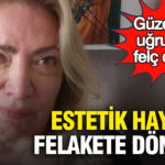 estetik-hayali-felakete-donustu-guzellik-ugruna-felc-oldu-1ZekMy8w